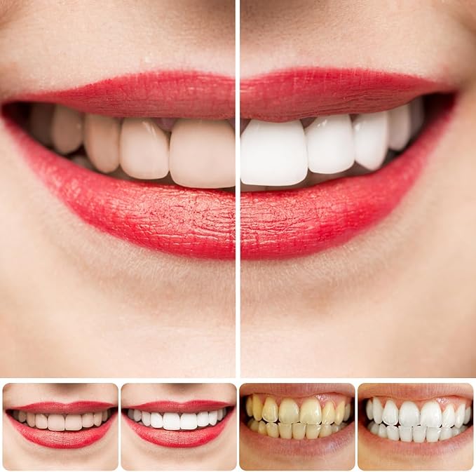Whitening Toothpaste